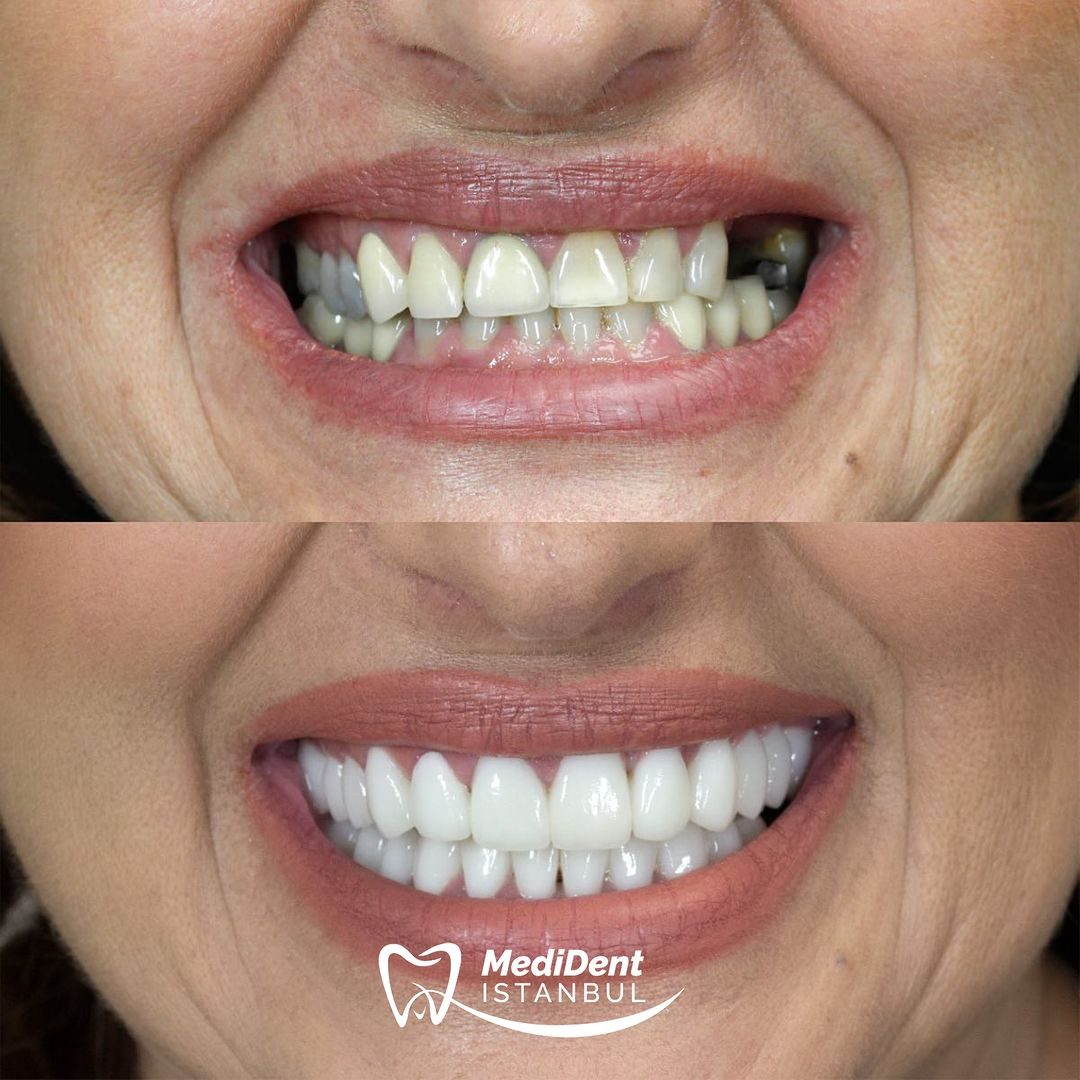 MediDent İstanbul